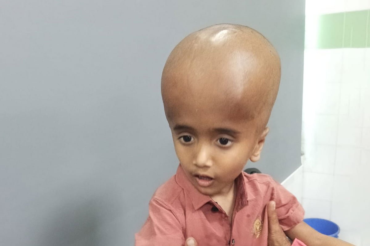 বড় মাথার যন্ত্রণায় ছটফট করে শিশুটি