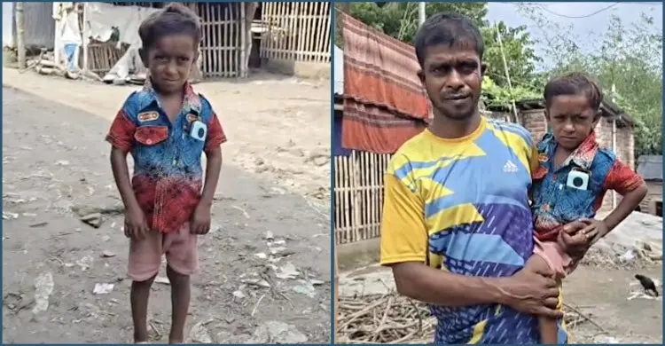 তিন বছরের শিশুর মতো দেখতে ১৭ বছরের ইয়াসিন, দুঃখই যেন তার জীবনসঙ্গী