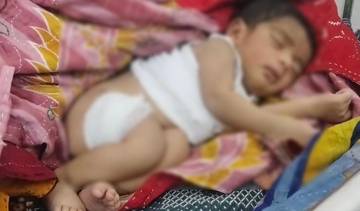 নবজাতকের পা ভাঙার অভিযোগ নার্সের বিরুদ্ধে 