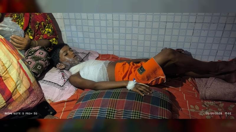 বাউফলে স্কুলে ডিমের গরম পানিতে ঝলসে গেল শিক্ষার্থী