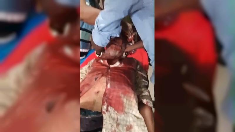 নবীগঞ্জে পূর্ব বিরোধের জেরে হামলা, আহত ৫