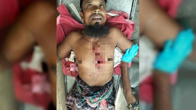 বেনাপোল বন্দরে ফর্কলিফটের দুর্ঘটনায় শ্রমিক আহত