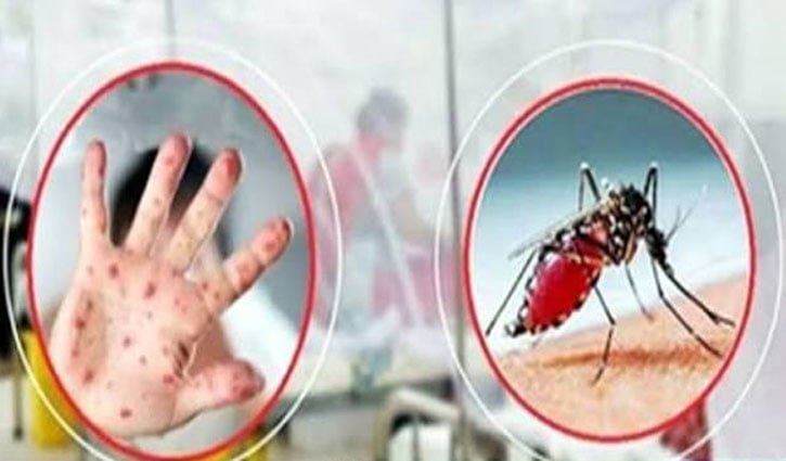 খুলনা বিভাগে হাম উপসর্গ ও ডেঙ্গুতে ৪ জনের মৃত্যু